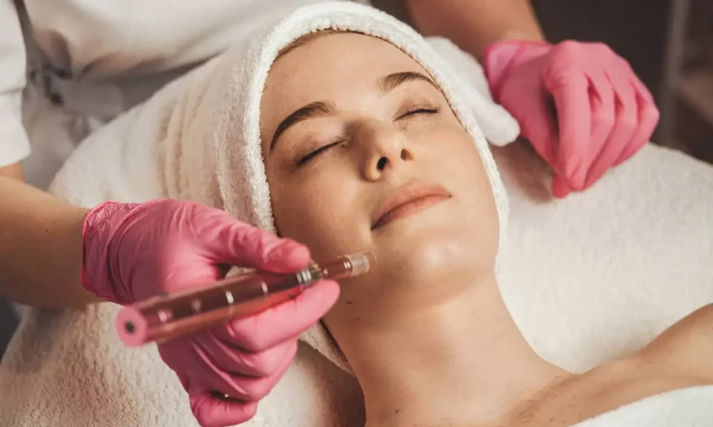Microneedling by Taylered Aesthetics in O'Neill NE