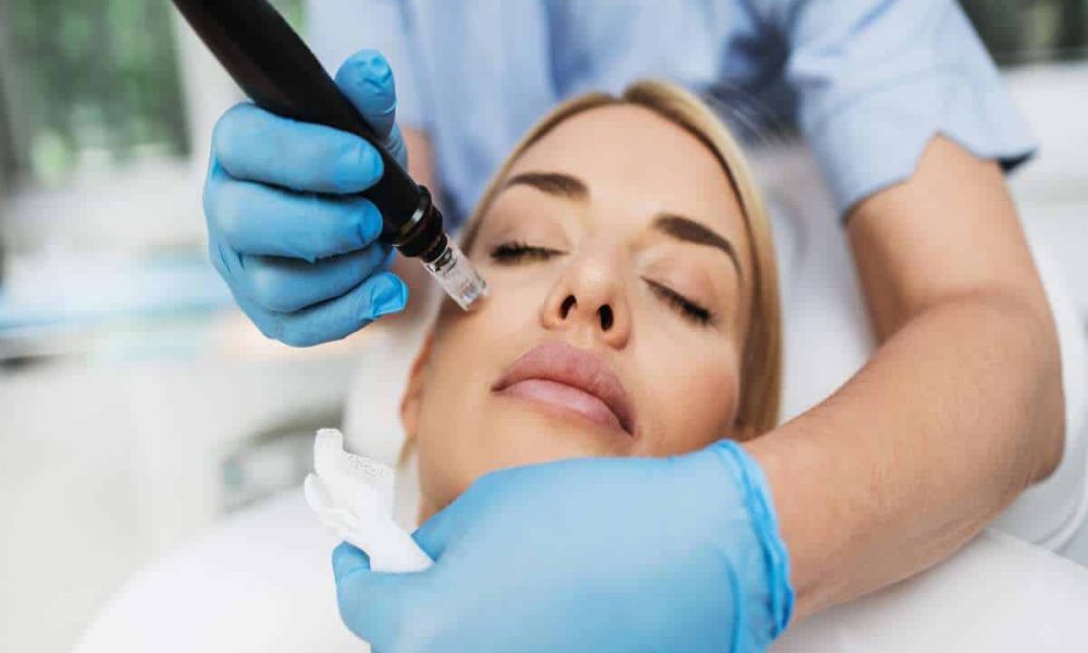 Microneedling by Taylered Aesthetics in ONeill NE