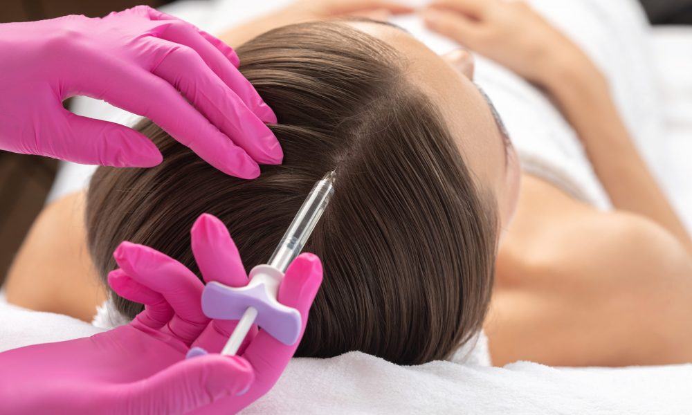 The Use Of Microneedling For Hair Regeneration