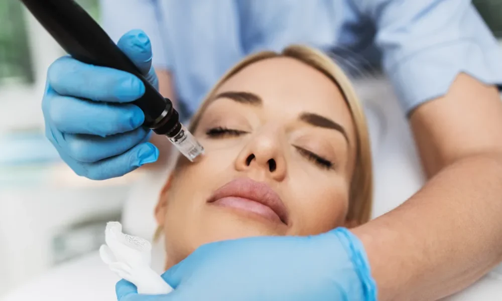 Women Receiving Microneedling in O'Neill, NE