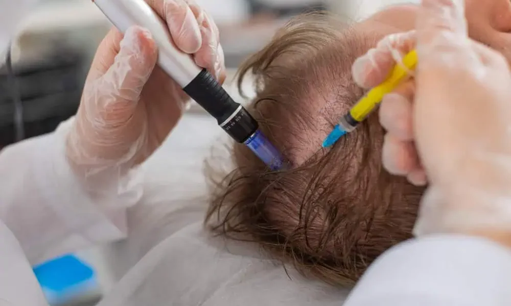 Hair Regeneration by Taylered Aesthetics in O'Neill, NE