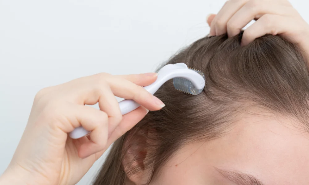 Hair regeneration treatment with derma roller on scalp by Taylered Aesthetics in O'Neill, NE